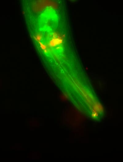 Climbing the Ladder to Longevity: Critical Enzyme Pair Identified