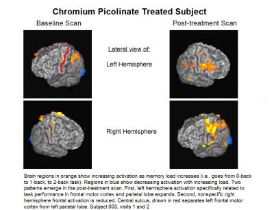 Chromium Picolinate Treated Subject