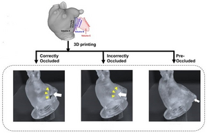 Production of three life-sized left atrial phantoms