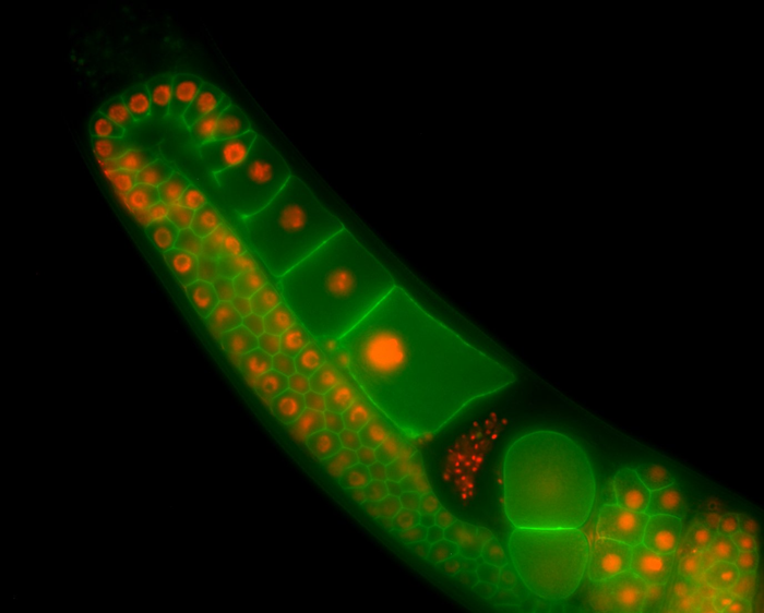 Worm expressing fluorescent proteins