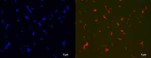 Fluorescent microscopy image of a bacterium forming membrane-spanning lipids