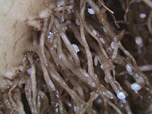 Young females of sugar beet cyst nematodes attached to host roots