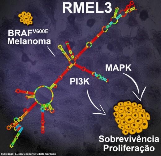 RMEL3 Expression is Enriched in Melanoma and Varies Across Disease Progression