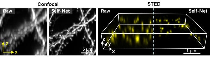 Fig. 2 | Self-Net improves 3D resolution isotropy of confocal microscopy and STED microscopy.