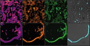 Chemical imaging of active gut microbes. After brief incubation with heavy water, culture medium and a drug, various chemical bonds (here C-D and C-H) in the stool sample are shown in yellow and green, their ratio in yellow-purple (left). Selected microbe