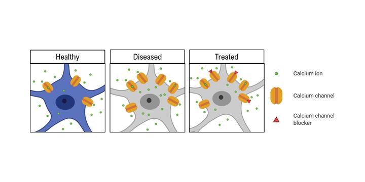 Treating Diseased Brain Cells with Calcium Channel Blockers