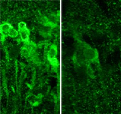 Neurons Produce Steroids in Response to Alcohol