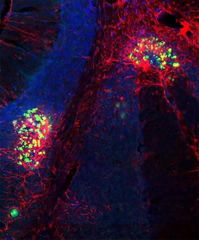 Persistence of Zika virus in the brain causes long-term problems in mice