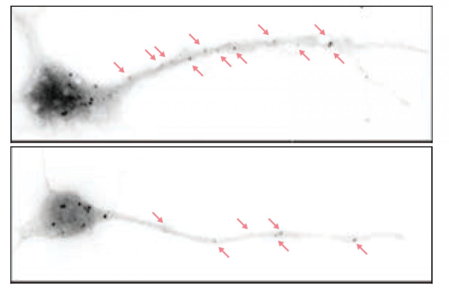 eIF4G Microexon Exclusion Hampers Pausing of Protein Synthesis in Neurons