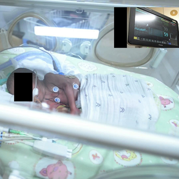 Non-contact monitoring a step closer for neonatal wards