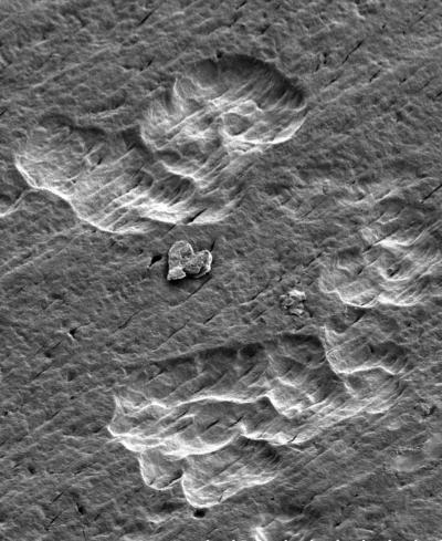 Osteoclast Resorbing Mineralized Matrix