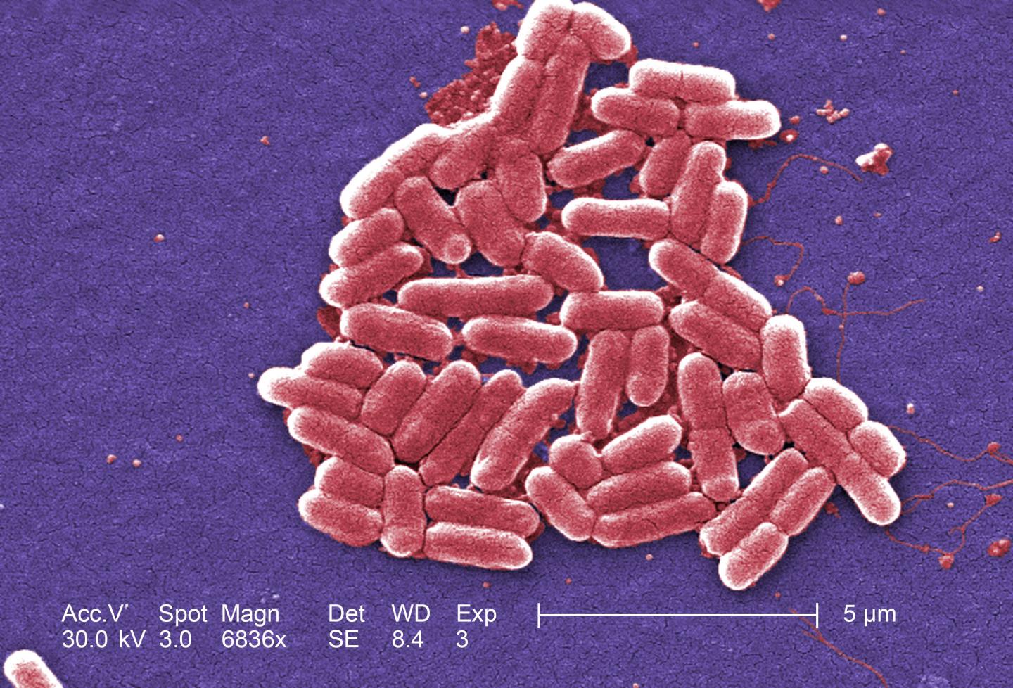 <i>E. coli</i> under a Scanning Electron Microscope