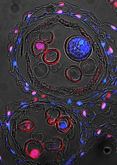 Fragmentation of DNA