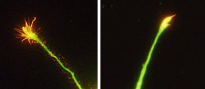 RGMa Halts a Growing Axon