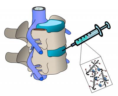 Schematic of Treatment Site
