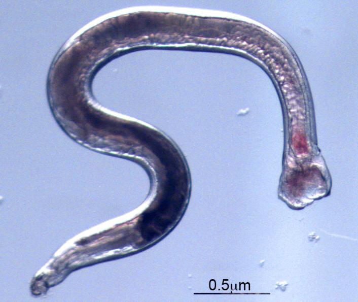 A 19-Day-post-Infection Male <i>Ancylostoma ceylanicum</i>