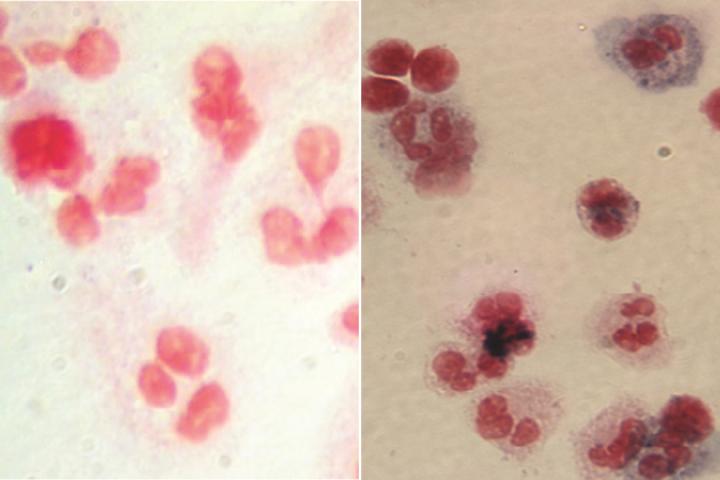 Patient Cells Before and After Gene Therapy