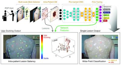Neural Network Could Help Clinicians Look for 