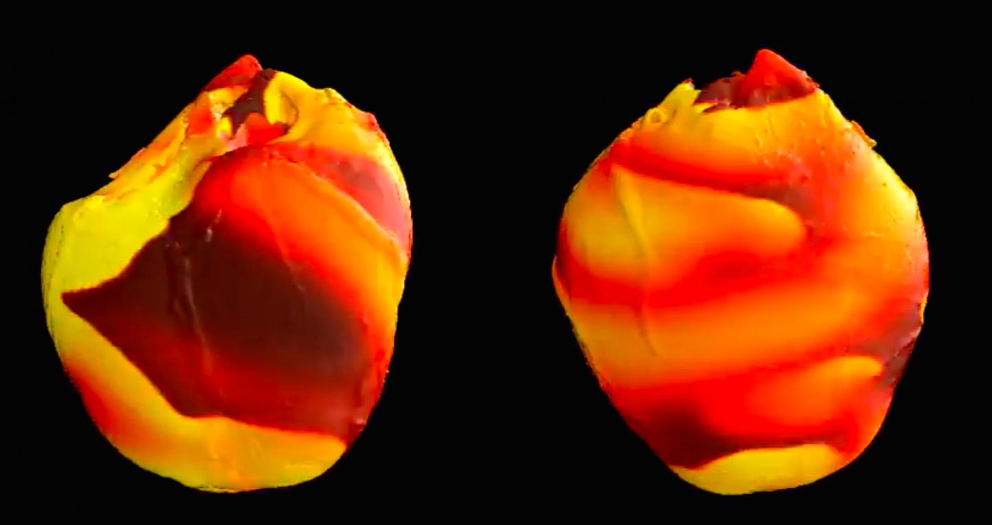 Simulation of Electrical Impulse Propagation through the Heart during Ventricular Fibrillation