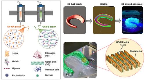 Bioengineered cartilage tissue