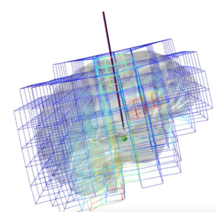 A New Simulation Tool for Brain Surgeons