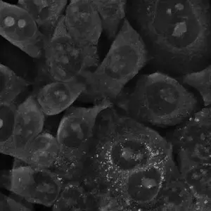 Small gold nanoparticles don't kill colon cancer cells