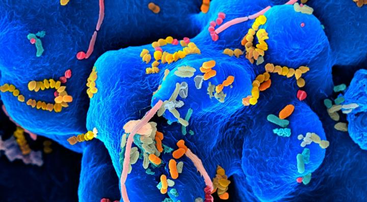 Gut Microbes, Rob Knight, University of California San Diego School of Medicine