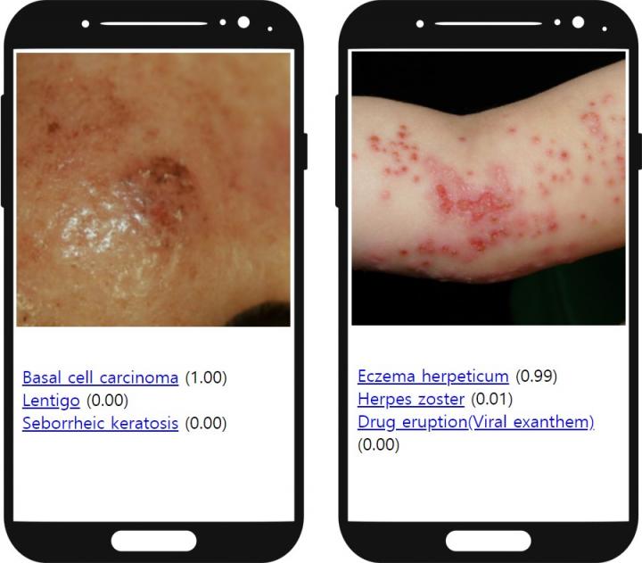 New Artificial Intelligence System Can Empower Medical Professionals in Diagnosing Skin Diseases