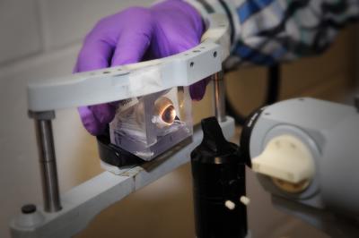 Scholars Study Hidden Eye Injuries Caused by Explosives
