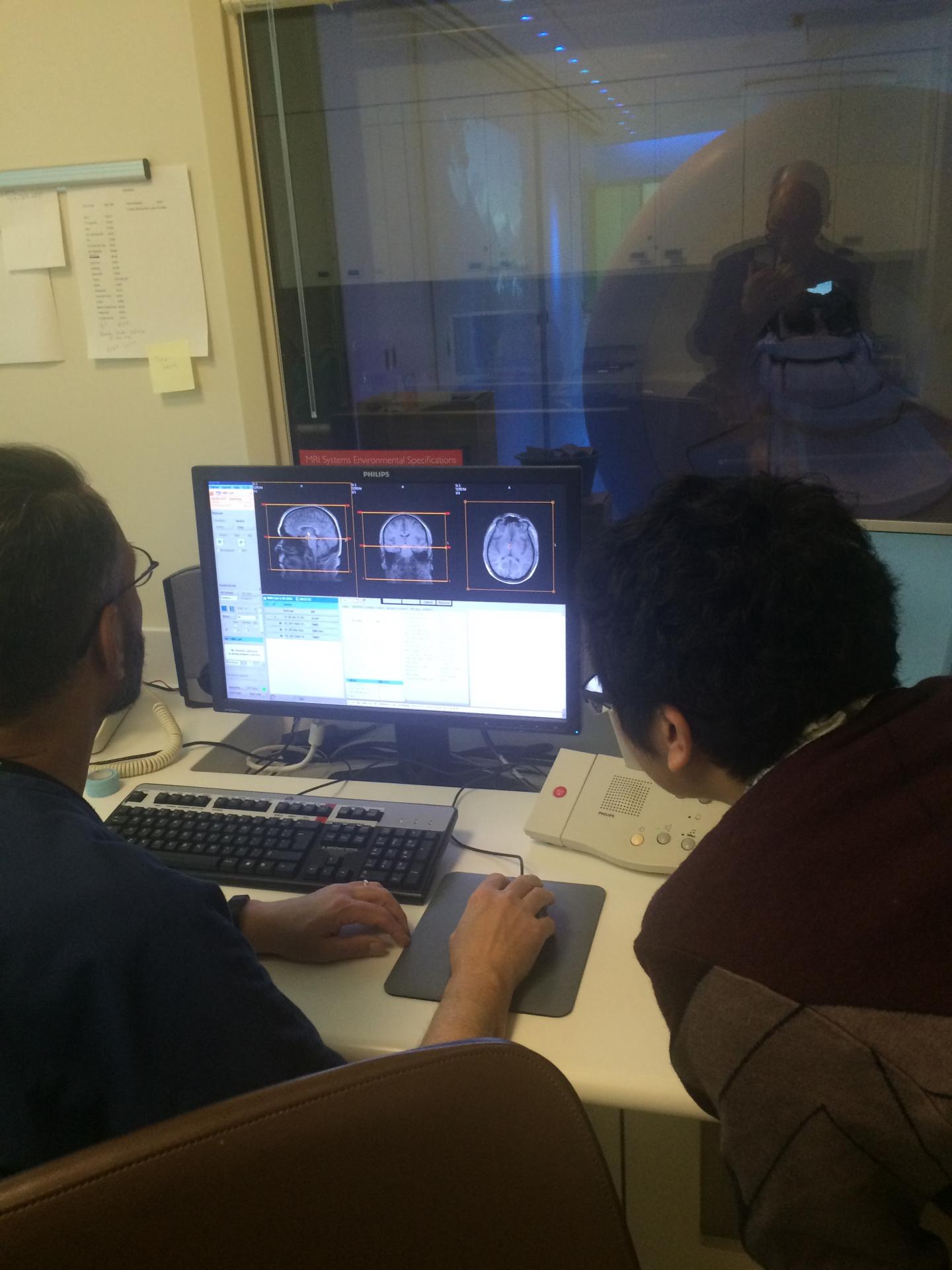fMRI Study of Brain Activation in Alzheimer's Disease