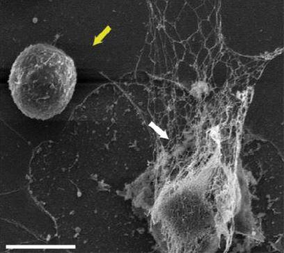 Nanoparticles Stop Metastatic Cancer from Hij | EurekAlert!