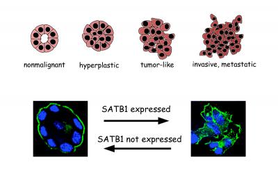 Expression of SATB1 in Acini