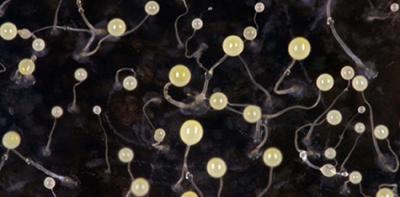 Social Amoeba with Fruiting Bodies