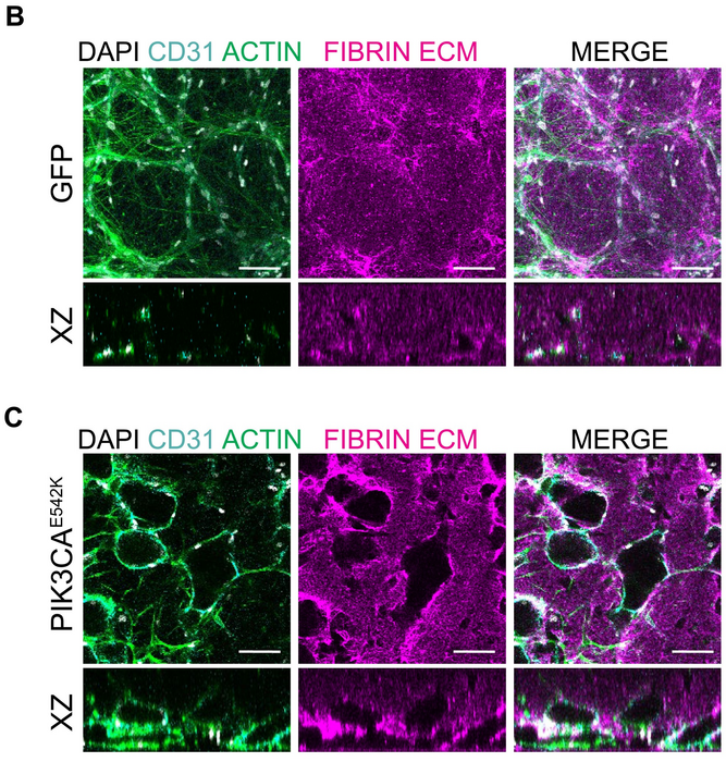 PIK3CAE542K vascular networks