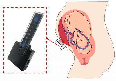 Prototype device may diagnose common pregnancy complications by monitoring placental oxygen