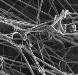 Enhanced Image of Platelet