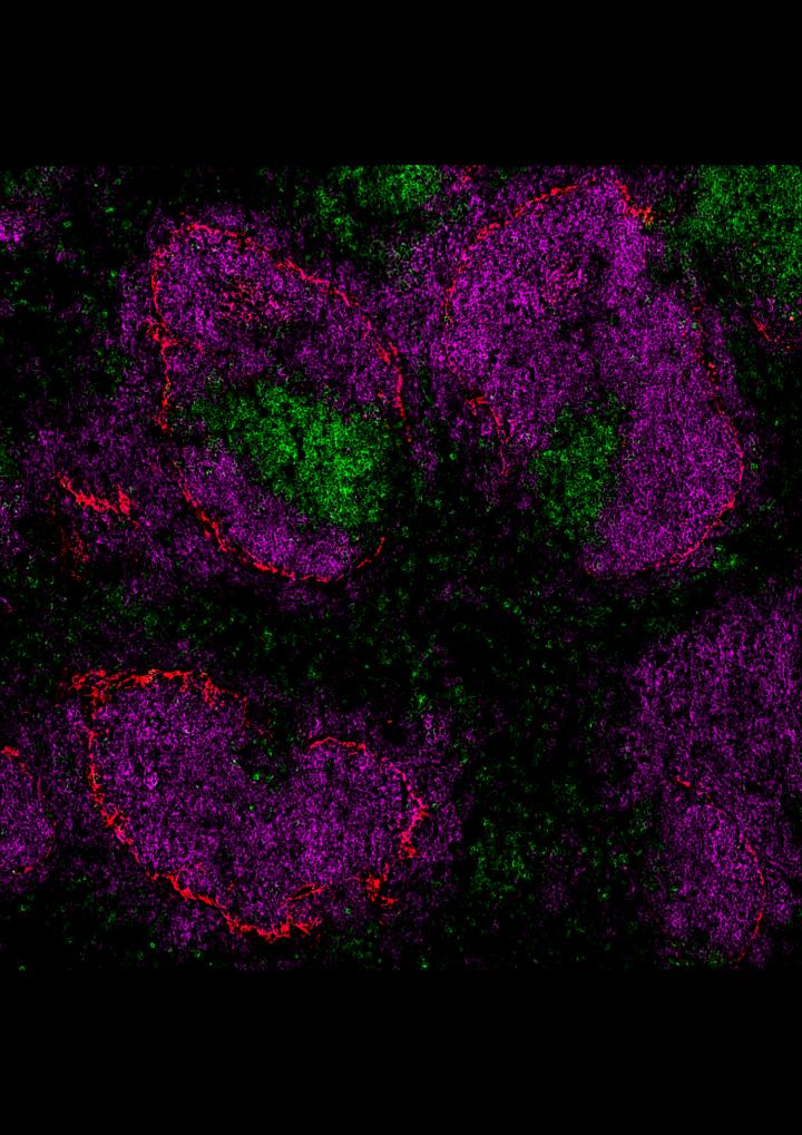 The Spleen In Immunohistological Staining
