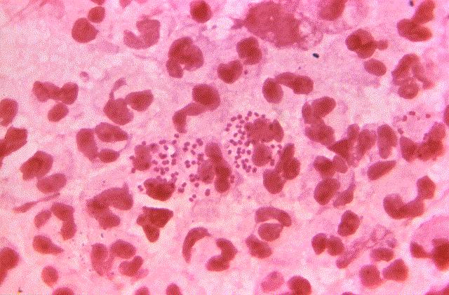 <i>Neisseria gonorrhoeae</i>