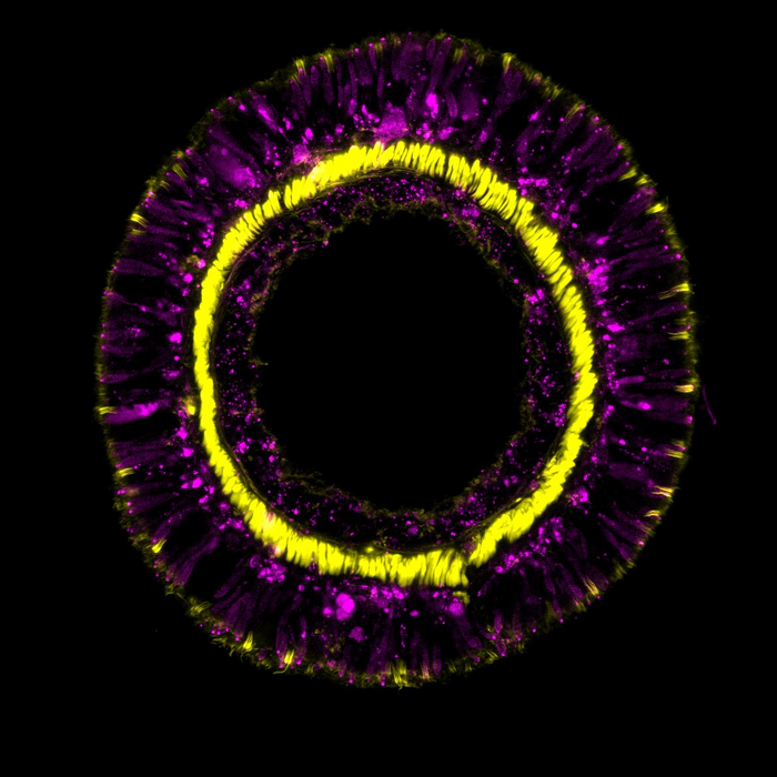 Fig. 1 : Cross-section through a tentacle of a transgenic sea anemone showing differentiation products of the SoxC cell population (magenta) and retractor muscles (yellow). (C: Andreas Denner)