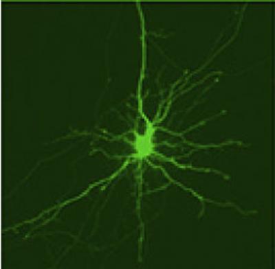 Optical Pulse-Labeling Used to Track Proteins in Brain Cells