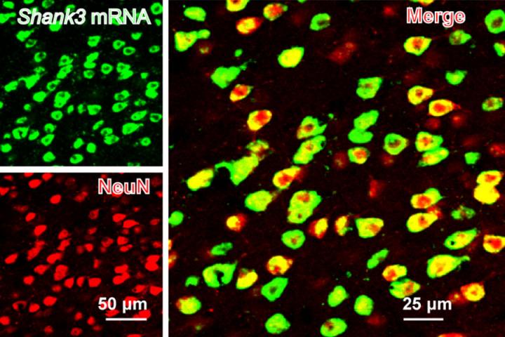 科学家发现了自闭症小鼠模型社交障碍的关键脑区| EurekAlert!