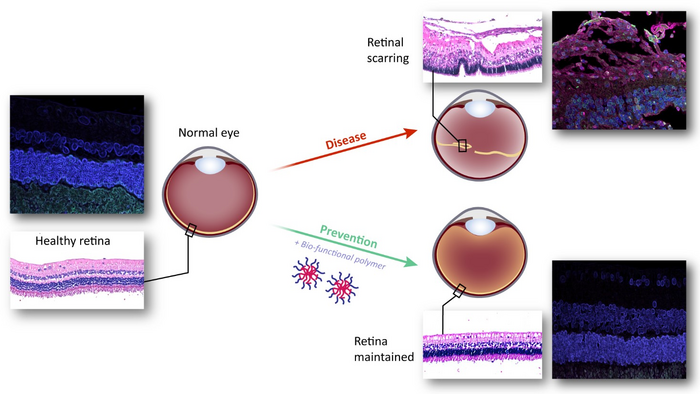 A Novel Therapy Using Unique Thermogel prevents Retinal Scarring