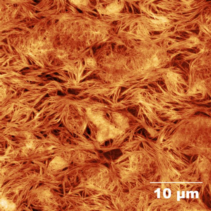 A Topographical View of the Mesh Capable of Growing Neurons