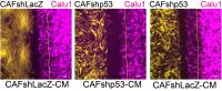The Effects of p53 in Cancer-associated Fibroblasts on Cancer Cell Migration