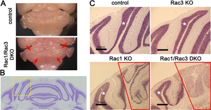 Defect of the Medial Cerebellum in Rac1/Rac3-DKO Mice