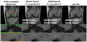 Knee MRI example