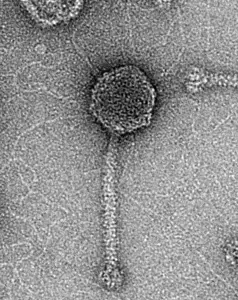 Microscope image of phage virus.