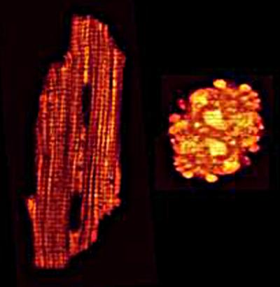 Live and Dead Heart Cells