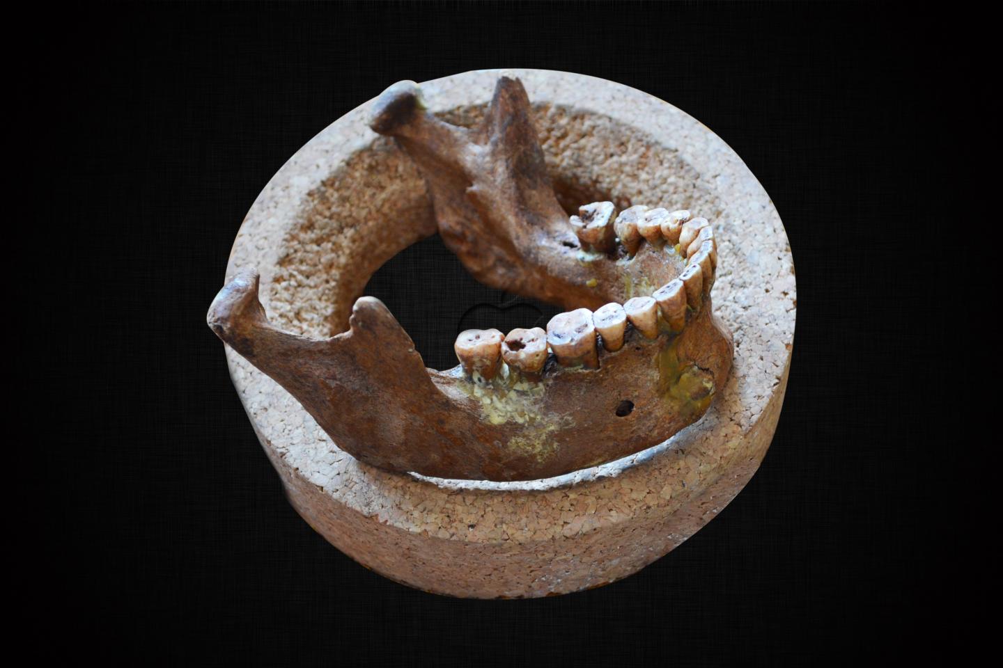 Lower Jaw and Teeth of Mesolithic Hunter-Gatherer