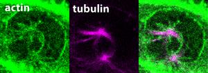 Excerpt from a film of living cells in the early stage of mitosis, the actin is colored green, the microtubules are colored purple.